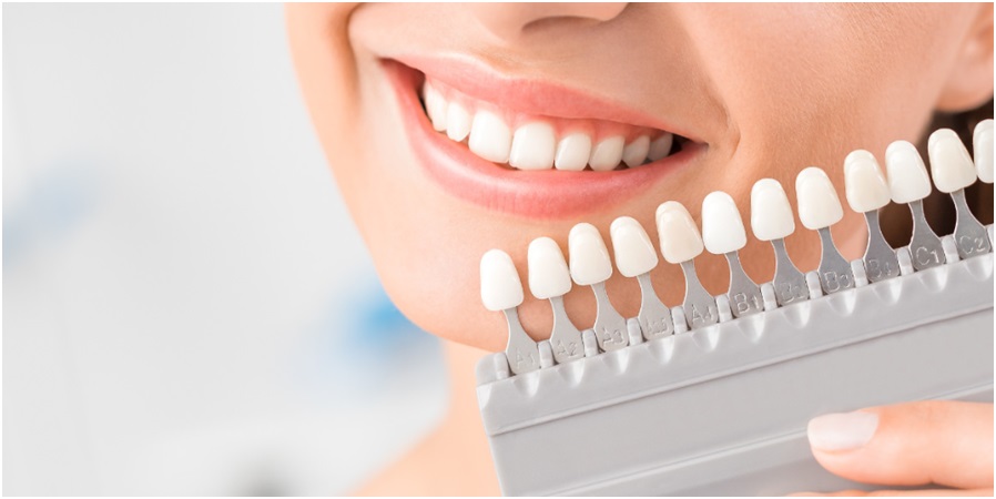 Dental Implants in Newcastle