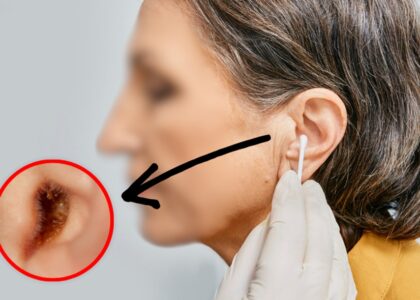 Earwax Removal