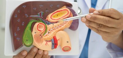 Gallbladder Removal