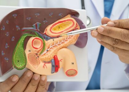 Gallbladder Removal